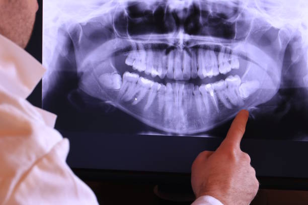 Best Broken Tooth Emergency  in Burnet, TX